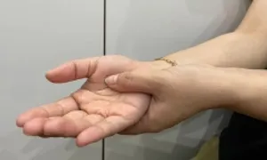 Run tay có phải dấu hiệu bệnh tuyến giáp?